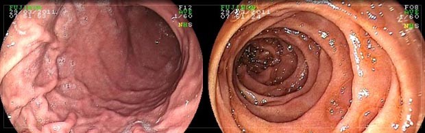 Leistungsspektrum der Klinik für Innere Medizin