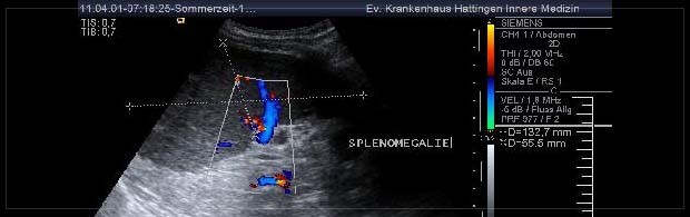 Hepatologie