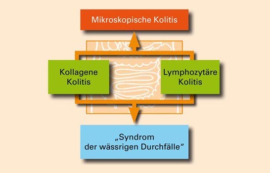 Definition Mikroskopische Kolitis